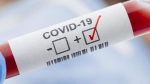 Covid, Sicilia ora è quarta per nuovi contagi falsi dati Covid Sicilia